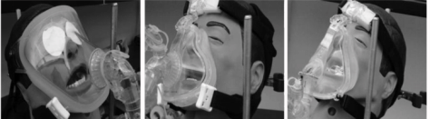 Comparison of drug delivery efficiency between mesh nebulizer, jet nebulizer and pMDI Comparison of drug delivery efficiency between mesh nebulizer, jet nebulizer and pMDI