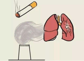 Diagnosis and treatment of pulmonary nodules Diagnosis and treatment of pulmonary nodules