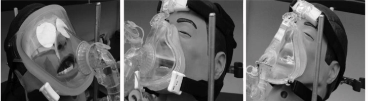 Comparison of drug delivery efficiency between mesh nebulizer, jet nebulizer and pMDI